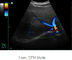 Escáner portátil ultrasónico del ultrasonido del dispositivo de diagnóstico de Ipad con almacenamiento de la imagen 500G