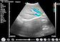 Uso obstétrico de la pediatría de ginecología de Doppler del ultrasonido del ultrasonido de mano de diagnóstico portátil casero de Doppler